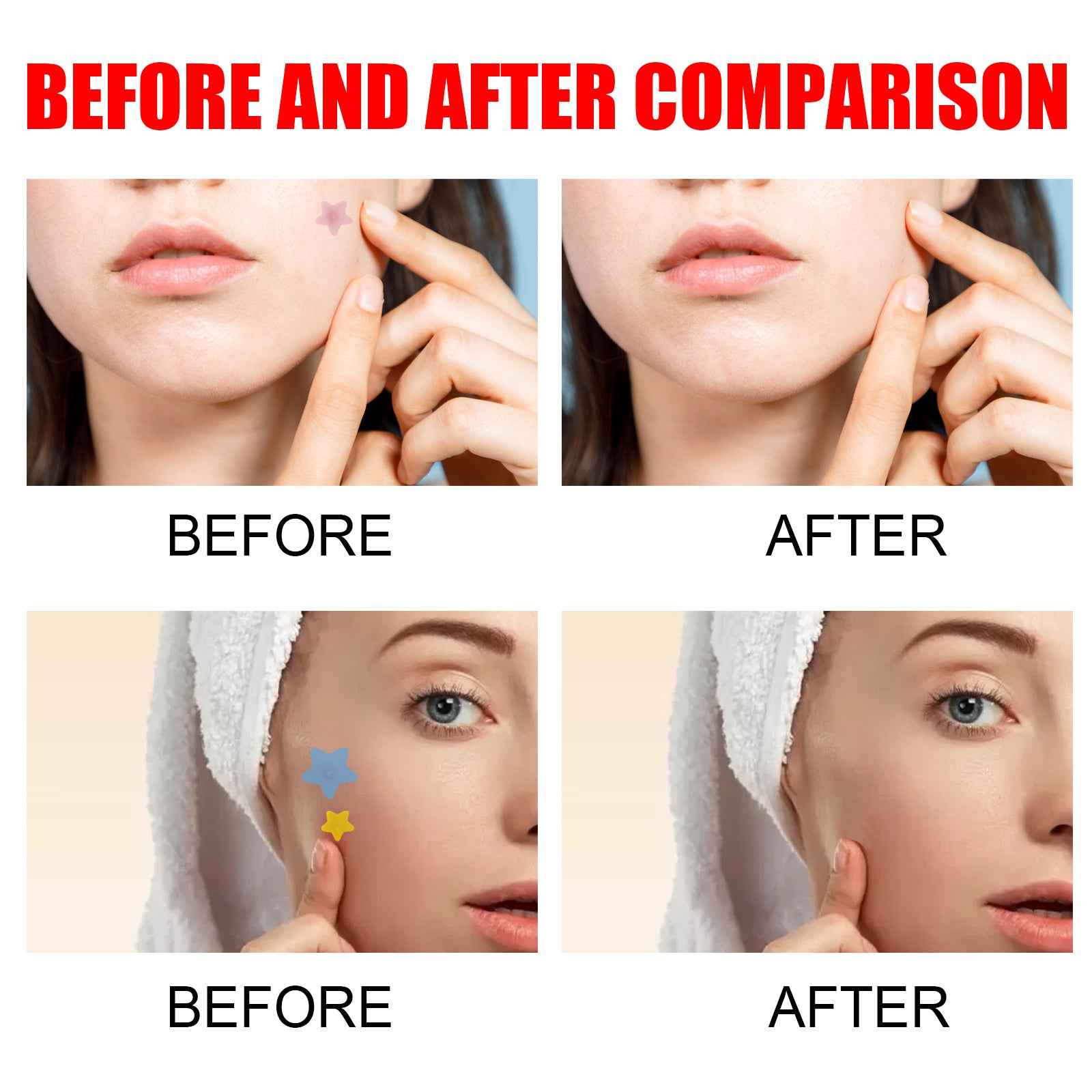 Pimple Patches,Pimple Patches For Face, Hydrocolloid Acne Patches, Cute Star Stickers Hydrocolloid Acne Pimple Patch For Covering Zits And Blemishes.
