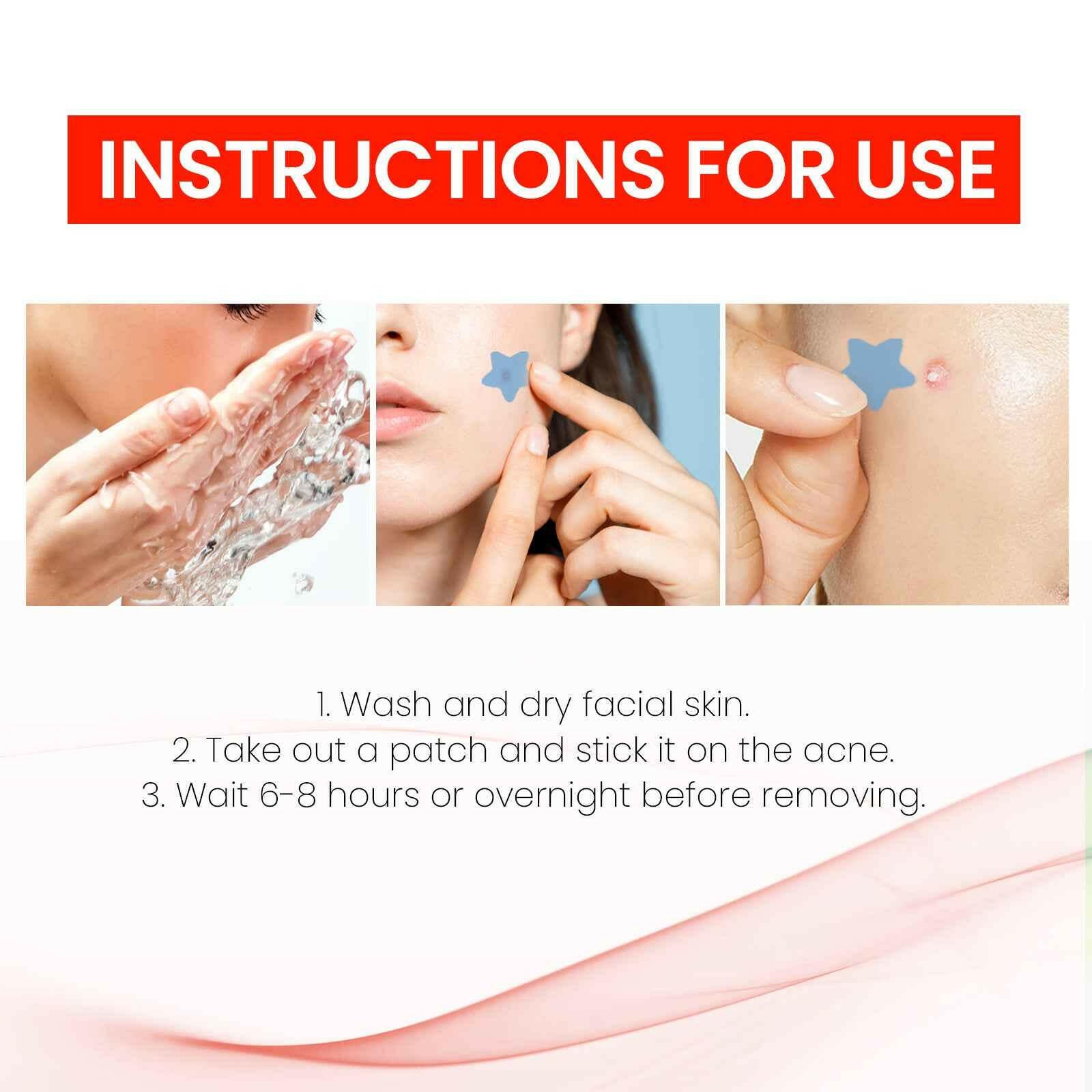Pimple Patches,Pimple Patches For Face, Hydrocolloid Acne Patches, Cute Star Stickers Hydrocolloid Acne Pimple Patch For Covering Zits And Blemishes.
