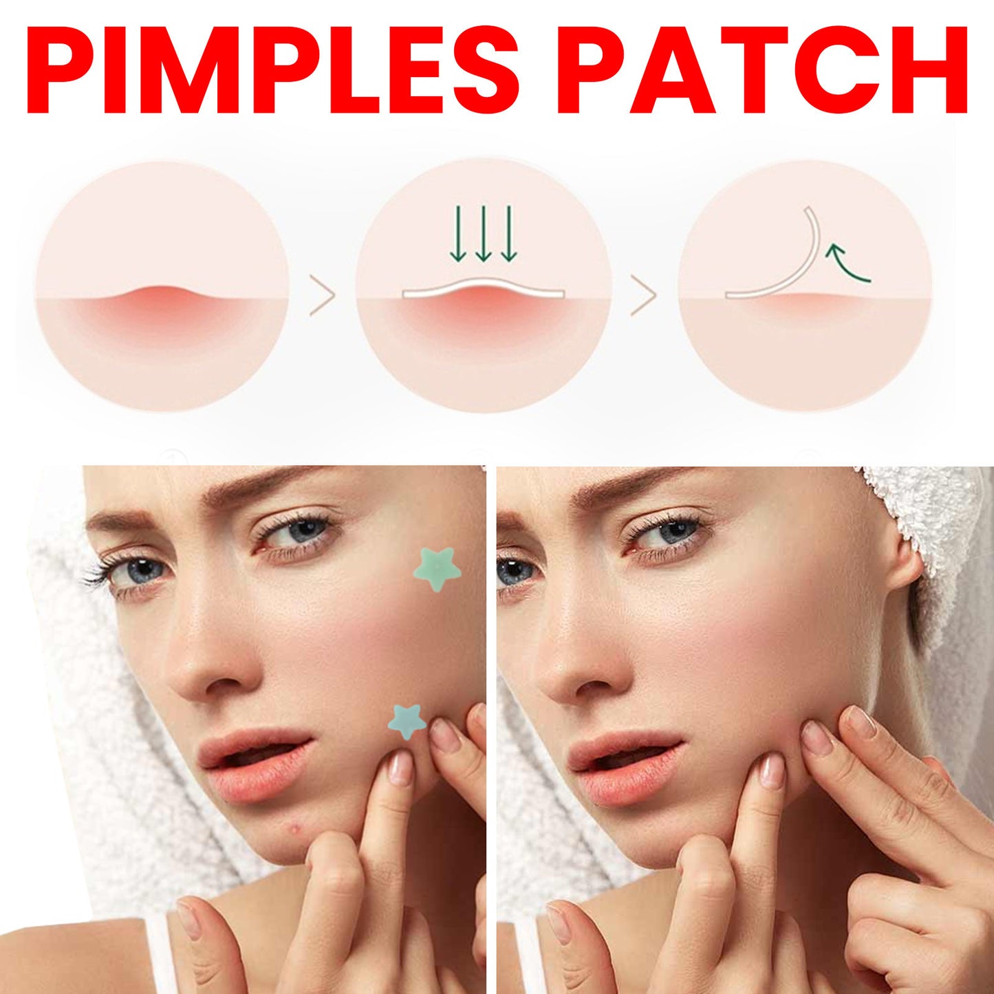 Pimple Spot Repair Patch | Desalting Acne Healing Hydrocolloid Skin Care - Bright Starz Store