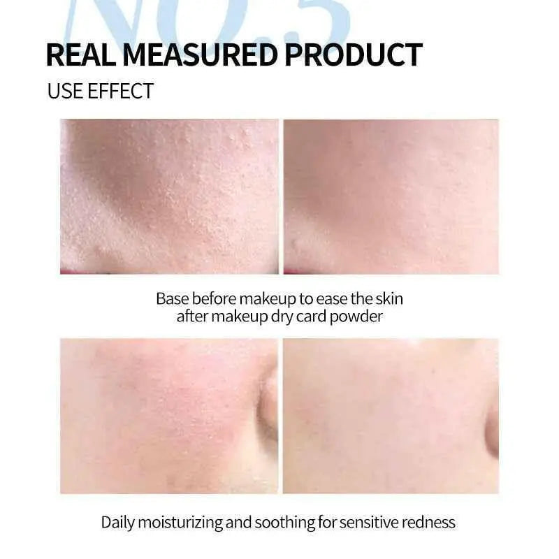 Hyaluronic Acid B5 Ceramide Moisturizing Supplement.