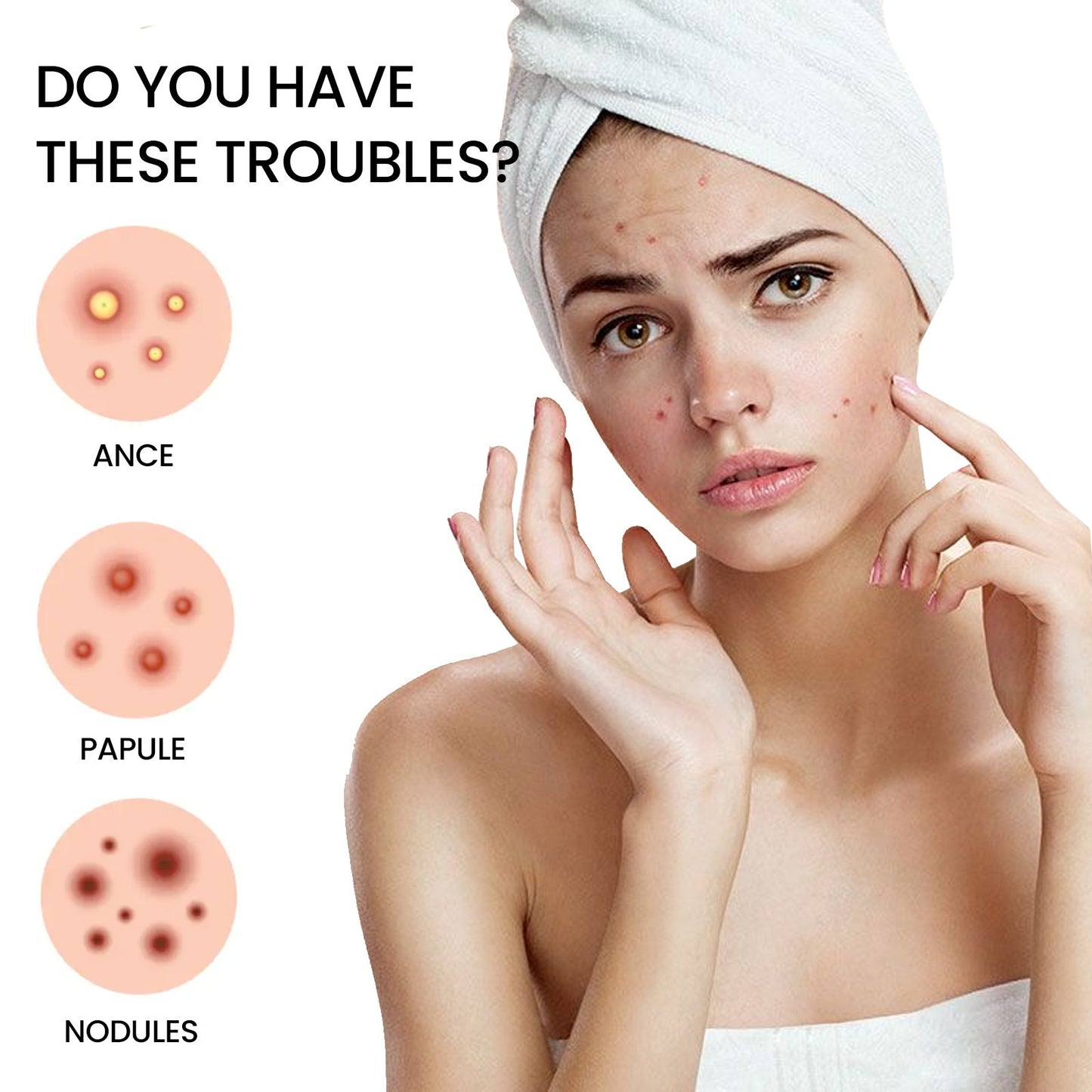 Pimple Spot Repair Patch | Desalting Acne Healing Hydrocolloid Skin Care - Bright Starz Store